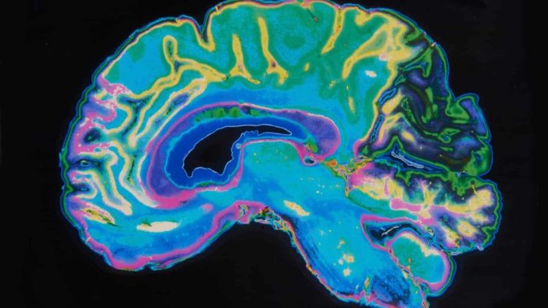 How LSD Affects The Brain